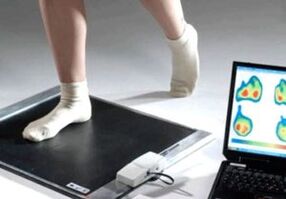 Diagnosi dell'alluce valgo