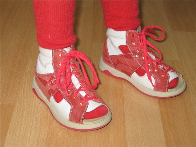 scarpe per bambini con alluce valgo