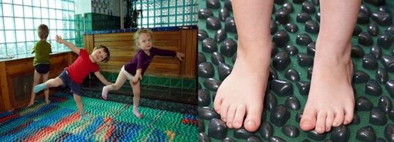 Ginnastica per deformazione di valgo