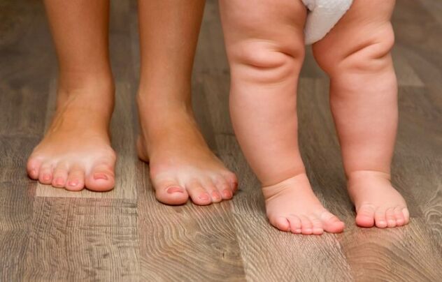 Valgo Deformazione del piede nei bambini
